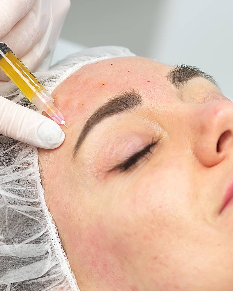 anti-age-soins-visage